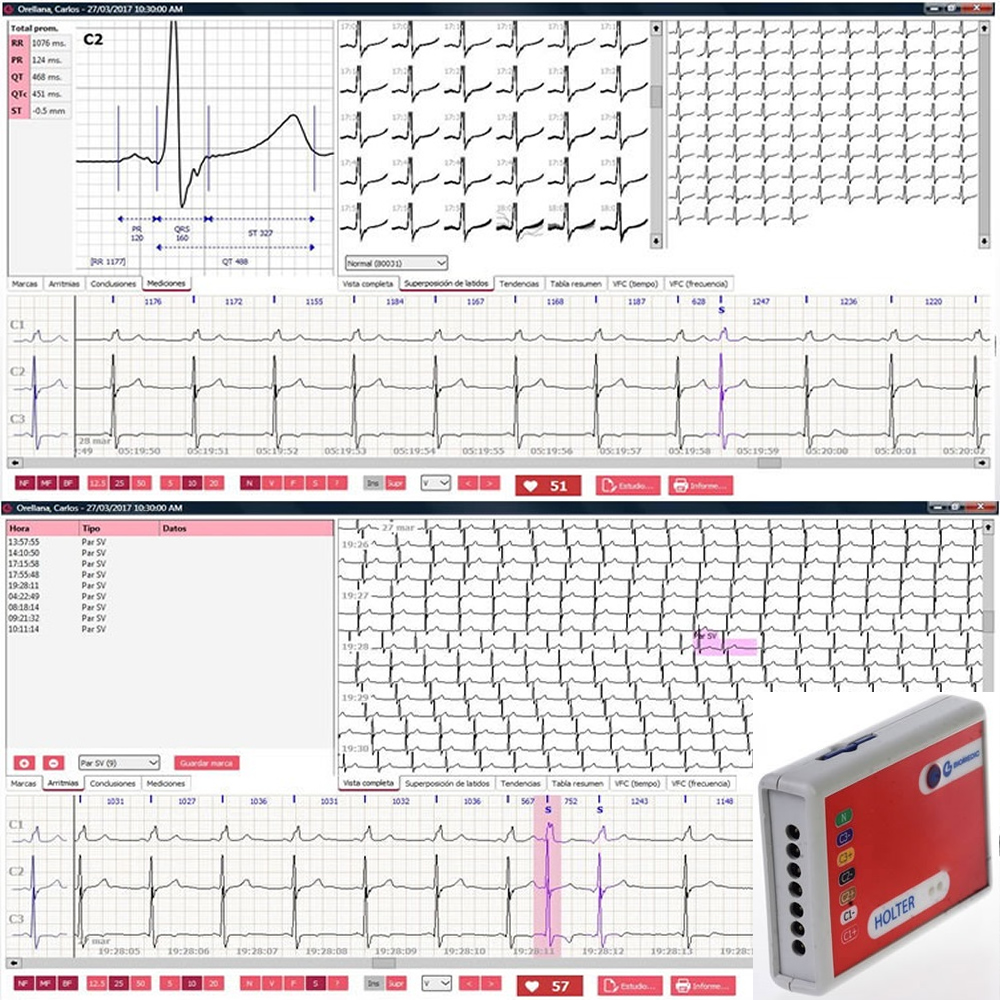 
Sistema de Holter ECG 3 canales
