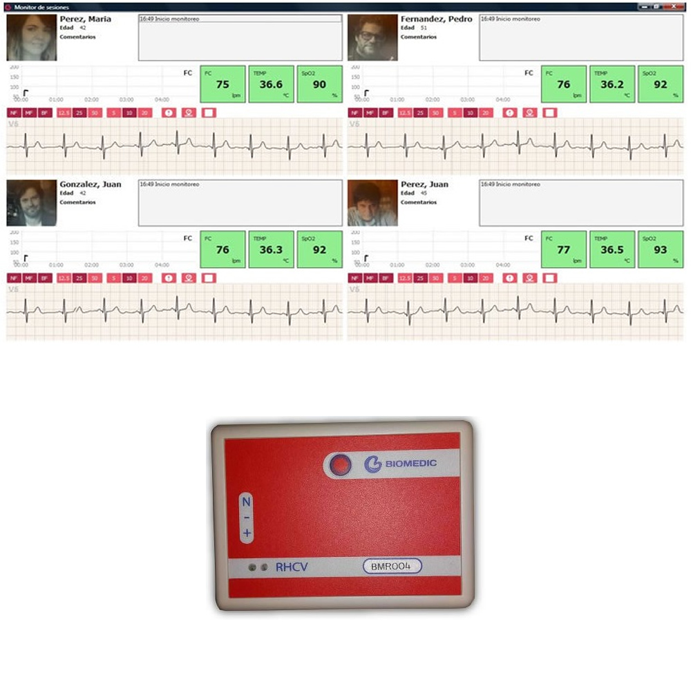 
Monitoreo Central ECG Rehabilitación Cardiovascular
