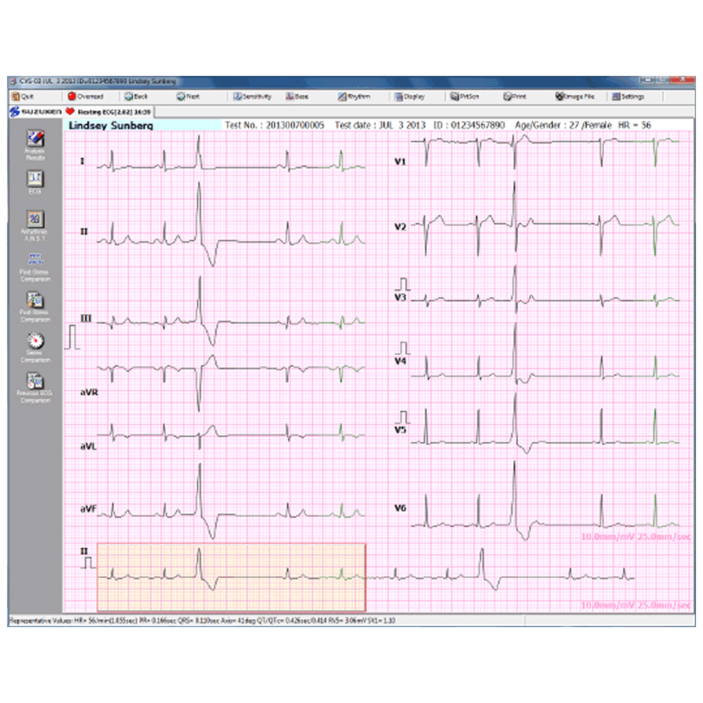 Software Vision Administracion Informacion Cardiologia Kenz CVS 03